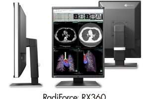 Màn hình EIZO RX360 cho Bệnh viện tại HCM