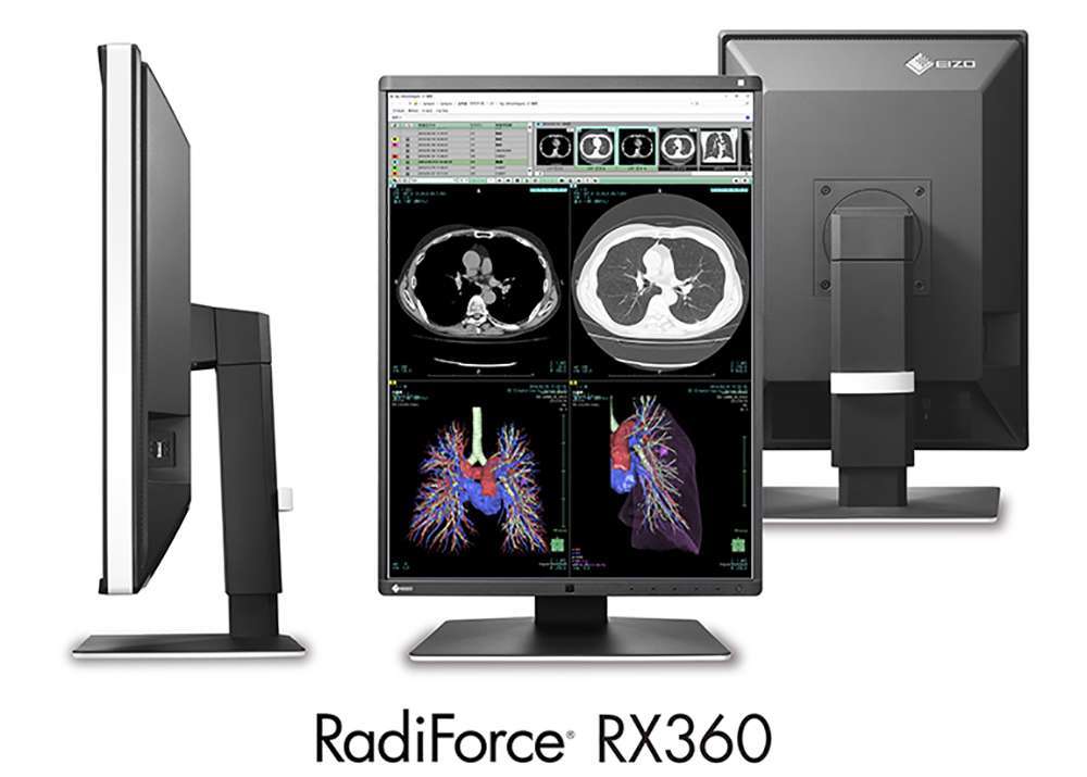Màn hình EIZO RX360 cho Bệnh viện tại HCM