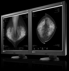màn hình chuyên dụng y tế chụp Xquang Vú EIZO GX 540