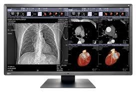 EIZO-Ứng dụng tối ưu chi phí trong lâm sàng