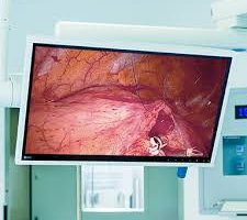 Màn hình chuyên dụng EIZO chuẩn DICOM Part 14 tại Bệnh viện Bạch Mai