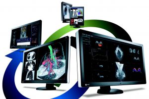 Màn hình y tế chẩn đoán ung thư vú của EIZO