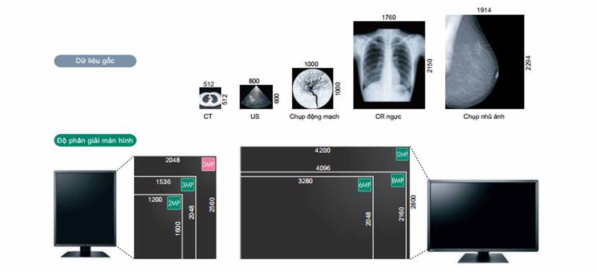 Màn hình chẩn đoán hình ảnh RadiForce EIZO 2 Màn hình xem lại lâm sàng RadiForce EIZO 2 Màn hình chẩn đoán hình ảnh RadiForce EIZO