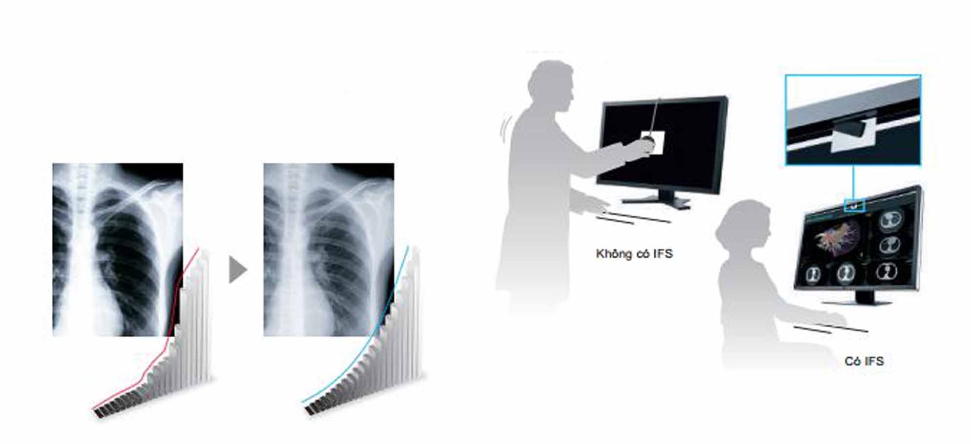 Màn hình chẩn đoán hình ảnh RadiForce EIZO 3 Màn hình xem lại lâm sàng RadiForce EIZO 3 Màn hình chẩn đoán hình ảnh RadiForce EIZO