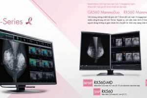 Màn hình chụp nhũ ảnh mammo EIZO Nhật