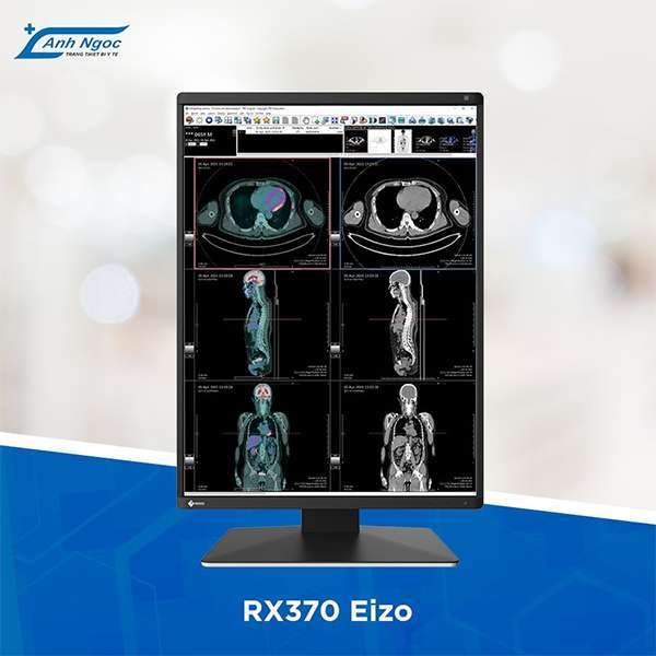 Anhngocmedical- Đơn vị chính hãng màn hình y tế EIZO Nhật 5 Ánh Ngọc Medical - Đơn vị phân phối độc quyền màn hình y tế EIZO Nhật