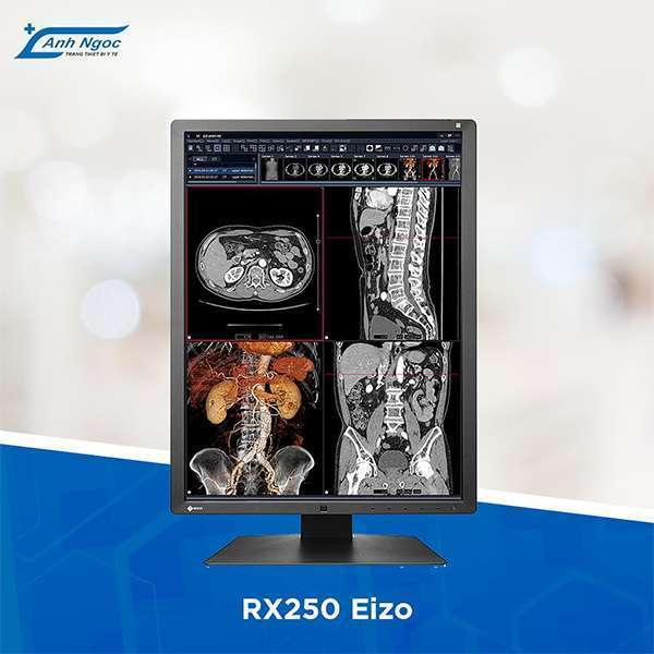 Anhngocmedical- Đơn vị chính hãng màn hình y tế EIZO Nhật 3 Ánh Ngọc Medical - Đơn vị phân phối độc quyền màn hình y tế EIZO Nhật