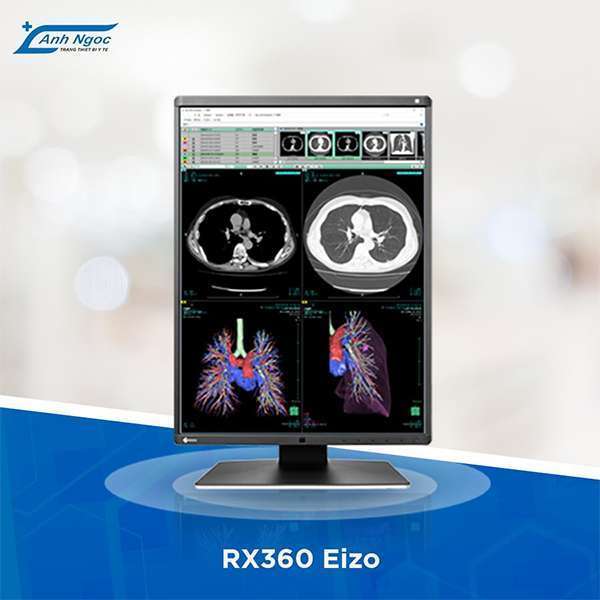 Anhngocmedical- Đơn vị chính hãng màn hình y tế EIZO Nhật 4 Ánh Ngọc Medical - Đơn vị phân phối độc quyền màn hình y tế EIZO Nhật