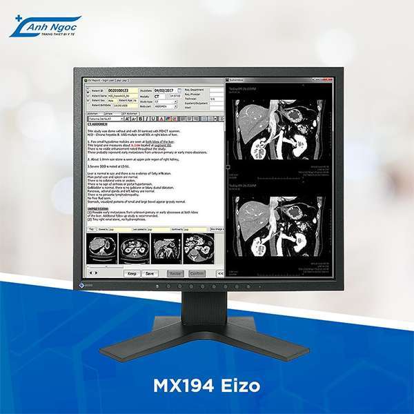 Anhngocmedical- Đơn vị chính hãng màn hình y tế EIZO Nhật 6 Ánh Ngọc Medical - Đơn vị phân phối độc quyền màn hình y tế EIZO Nhật