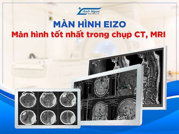 Anhngocmedical- Đơn vị chính hãng màn hình y tế EIZO Nhật 2 Ánh Ngọc Medical - Đơn vị phân phối độc quyền màn hình y tế EIZO Nhật