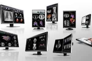 EIZO –  Hãng sản xuất màn hình y tế hàng đầu thế giới