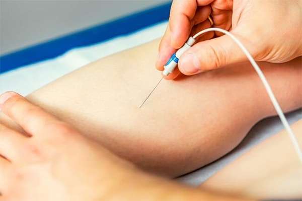 Máy điện cơ kỹ thuật số là gì? 1 số hãng được sử dụng nhiều? 1 Máy điện cơ kỹ thuật số