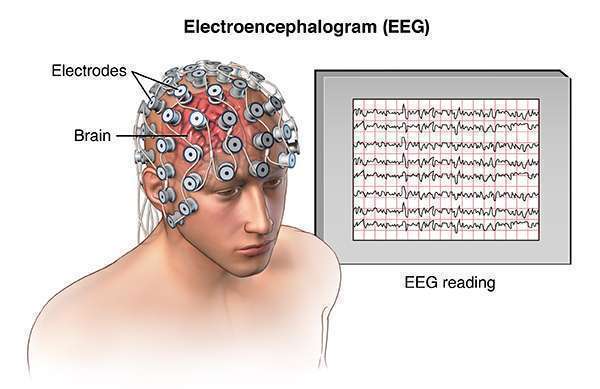 Máy điện não kỹ thuật số