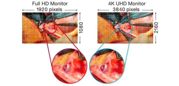 Màn hình 4K có thể hiển thị rõ ràng các đường khâu mà không bị mờ