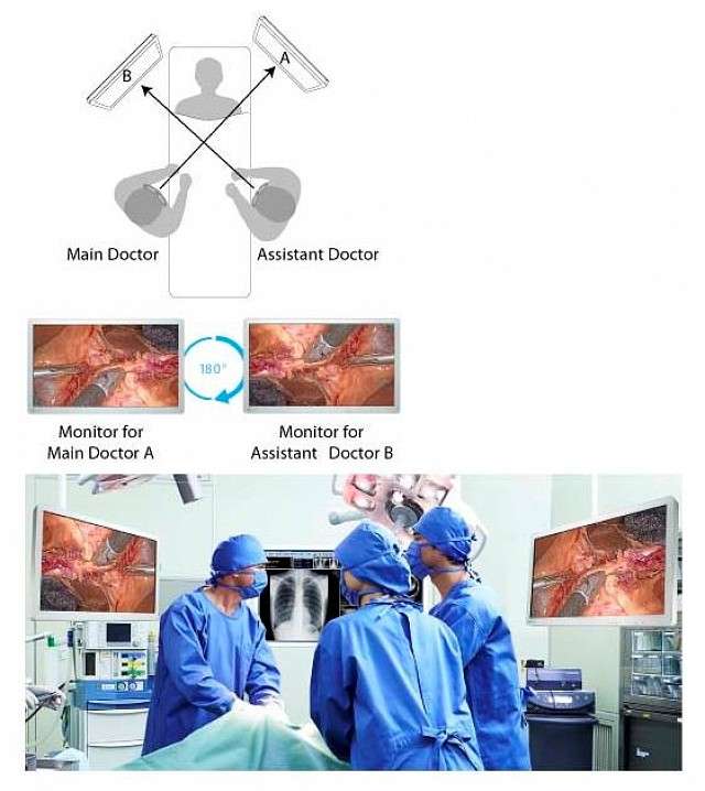 Monitor - Endo 2D - Rotation and Mirroring